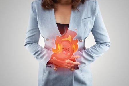 Acid reflux disease symptoms or heartburn 